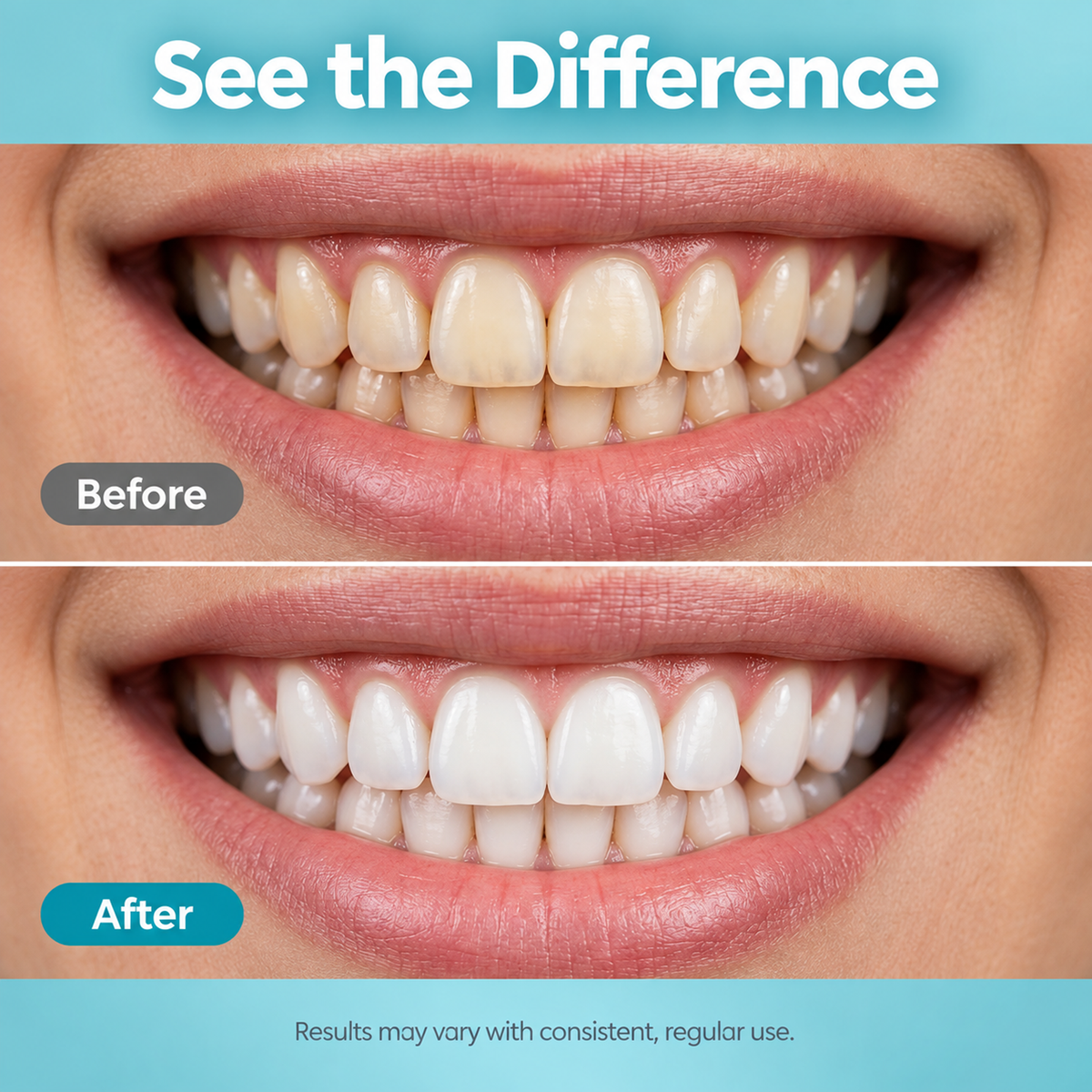 Teeth Whitening Strip - 21 Treatments (42 Strips)