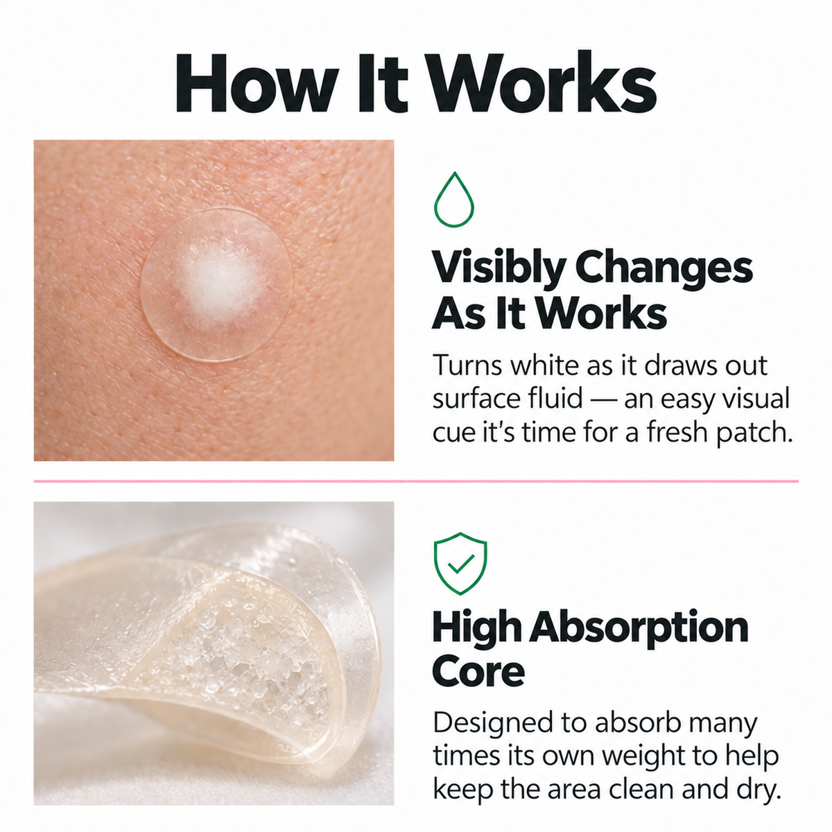 Acne Patches – 96 Hydrocolloid Spot Dots