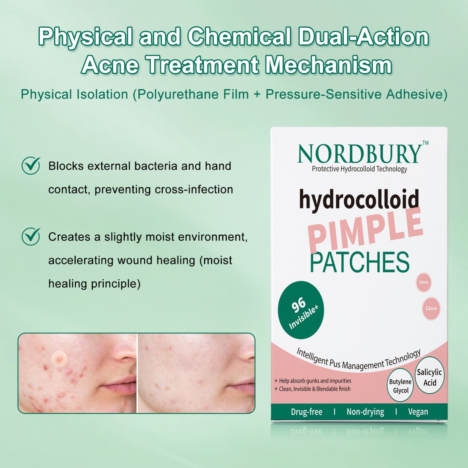 Acne Pimple Patches – Hydrocolloid Spot Dots